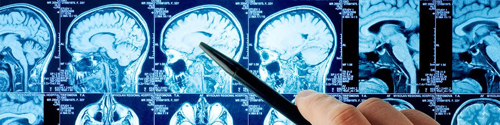 Diagnosing a Brain Injury